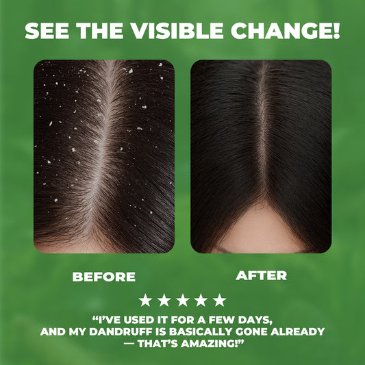 Herbal Shampoo Bar with Usma Herb, Thuja Leaf & Ginseng – Gentle Haircare Cleanser, Solid Soap for Daily Use