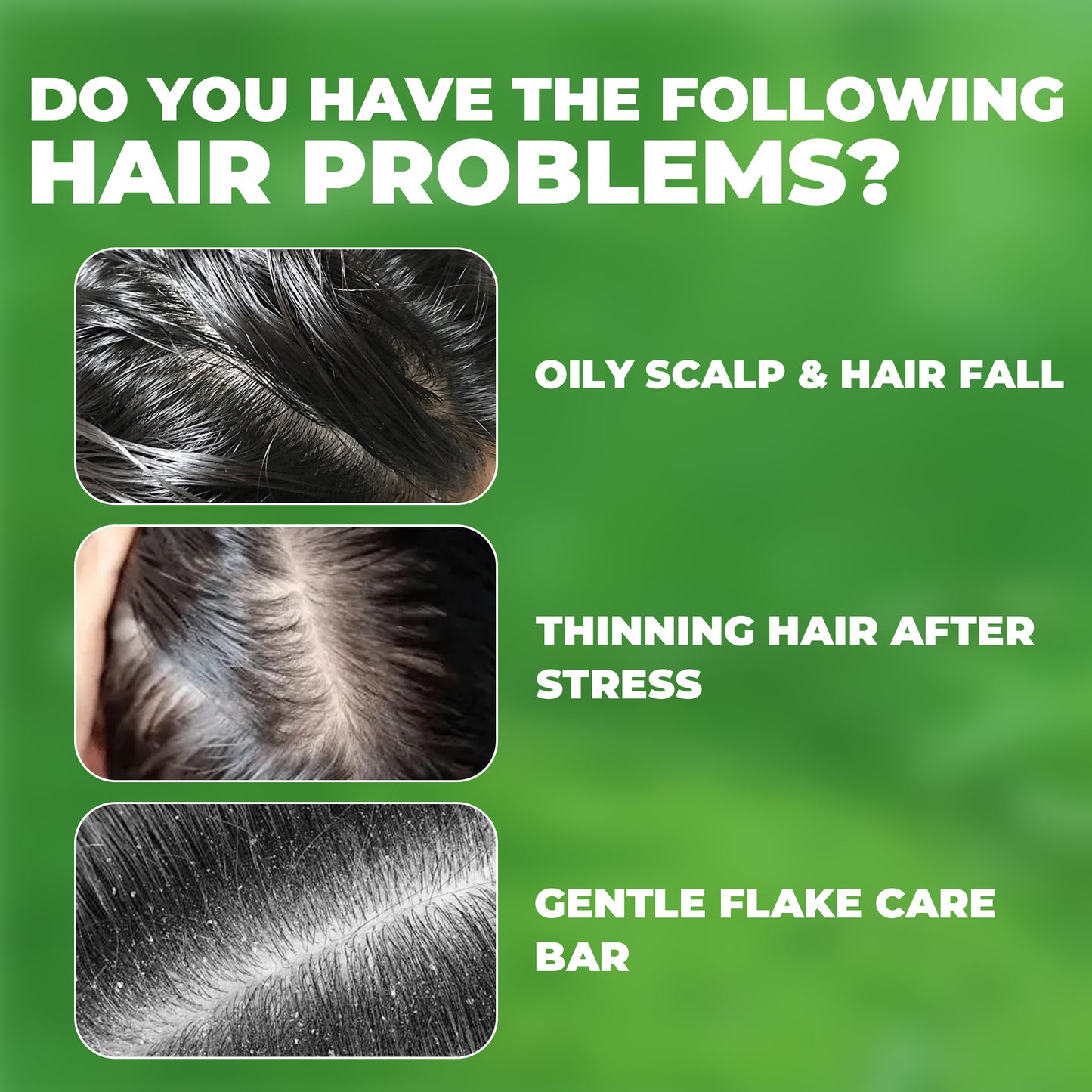 Herbal Shampoo Bar with Usma Herb, Thuja Leaf & Ginseng – Gentle Haircare Cleanser, Solid Soap for Daily Use